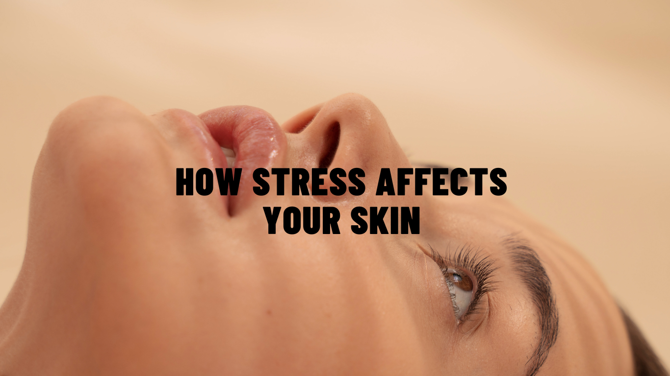 How Stress Affects Your Skin and Ways to Manage It